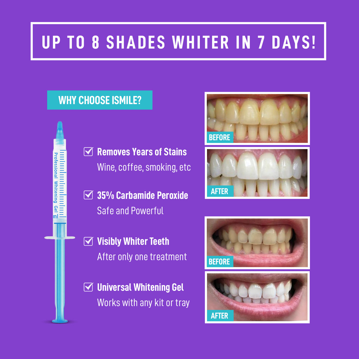 diy teeth whitening gel